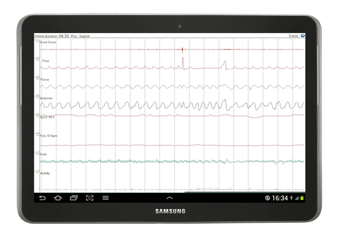 Передайте измеренные данные на планшет, ПК или смартфон для мгновенной проверки сигнала - прямо у постели пациента или на мобильном телефоне в виде снимка экрана.